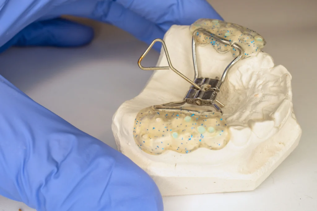 orthodontie appareil expansion palatine puateaux nanterre Orthodontie enfant wongeczowski